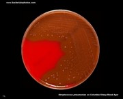 pneumococcus on columbia blood agar